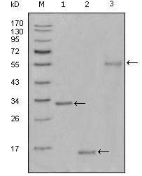 Ki-67 Monoclonal Antibody – Figure 1 of 1