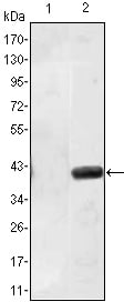 Matrilin-1 Monoclonal Antibody – Figure 1 of 2