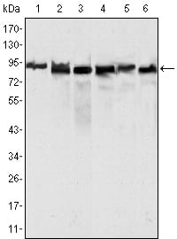 MLH1 Monoclonal Antibody – Figure 1 of 3