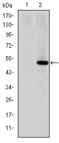 MMP-1 Monoclonal Antibody – Figure 1 of 4
