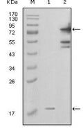 PBEF Monoclonal Antibody – Figure 1 of 1