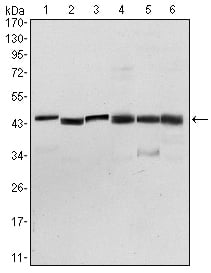 PDK1 Monoclonal Antibody – Figure 1 of 4