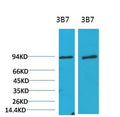 PI3 Kinase P85 Alpha Monoclonal Antibody(3B7) – Figure 1 of 3