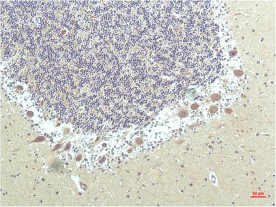 PPAR Delta mouse Monoclonal Antibody(1D7) – Figure 1 of 2