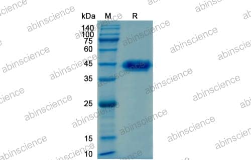 SDS-PAGE for Enterokinase