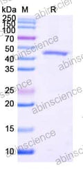 SDS-PAGE for Terminal Transferase (TdT)