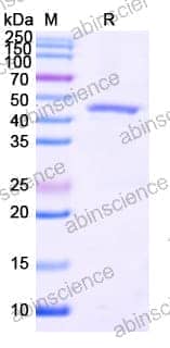 SDS-PAGE for Terminal Transferase (TdT)