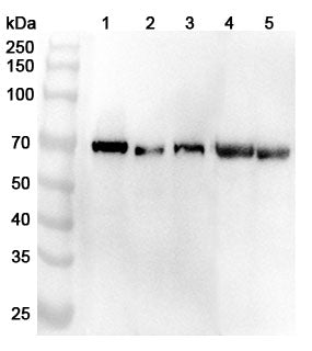 Western blot analysis was performed using anti-ALB polyclonal antibody at 1ug/mL on various samples.
Lane 1: Hela cell lysate
Lane 2: LO2 cell lysate
Lane 3: NIH3T3 cell lysate
Lane 4: Rat kidney lysate
Lane 5: Rat spleen lysate