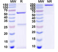Sandwich ELISA: For BSA binding analysis, plates were coated with BSA Antibody (9D3)(BY411063) .After blocking, add standard, plates were incubated with BSA Antibody (12D6), HRP(BY411913).