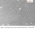 Immortalized Human Type II Alveolar Epithelial Cells - SV40T+hTERT | Applied Biological Materials (abm)