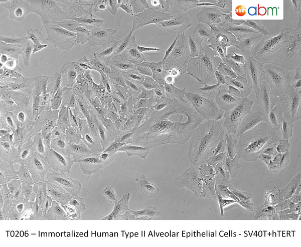Immortalized Human Type II Alveolar Epithelial Cells - SV40T+hTERT | Applied Biological Materials (abm)