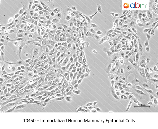 Immortalized Human Mammary Epithelial Cells – Figure 1 of 1