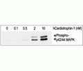 Recombinant human Cardiotrophin-1 protein