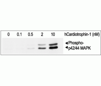 Recombinant human Cardiotrophin-1 protein