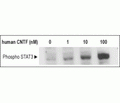 Recombinant human CNTF protein