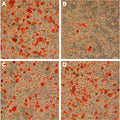 Cyclosporin A – Figure 1 of 2