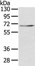 TBL1X Polyclonal Antibody – Figure 1 of 2