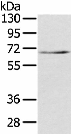 TBL1X Polyclonal Antibody – Figure 1 of 2