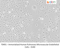 Immortalized Human Pulmonary Microvascular Endothelial Cells - SV40 | Applied Biological Materials (abm)