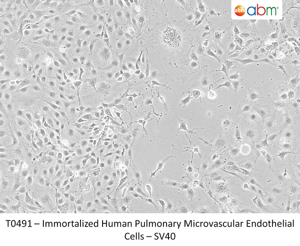 Immortalized Human Pulmonary Microvascular Endothelial Cells - SV40 | Applied Biological Materials (abm)