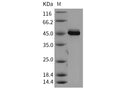 Recombinant Mouse AKT3 Protein (aa 106-479) – Figure 1 of 2