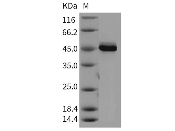 Recombinant Mouse AKT3 Protein (aa 106-479) – Figure 1 of 2
