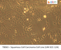 Squamous Cell Carcinoma Cell Line (UM-SCC-124) | Applied Biological Materials (abm)