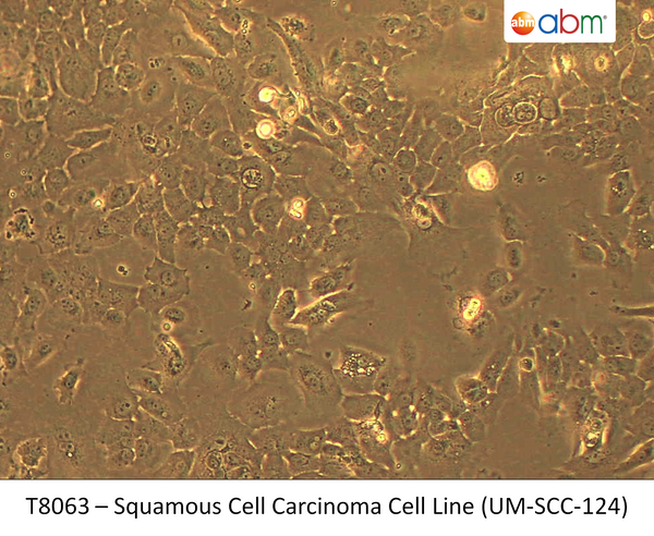 Squamous Cell Carcinoma Cell Line (UM-SCC-124) | Applied Biological Materials (abm)