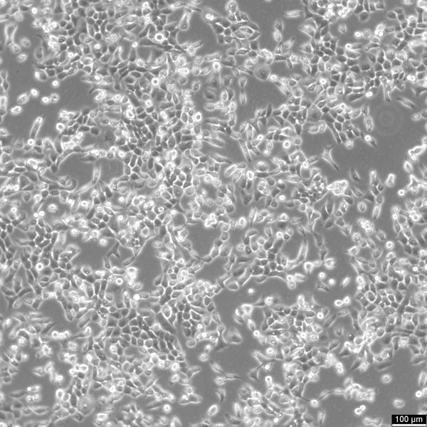 CAL 27 cell