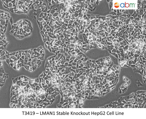 LMAN1 Stable Knockout HepG2 Cell Line | Applied Biological Materials (abm)