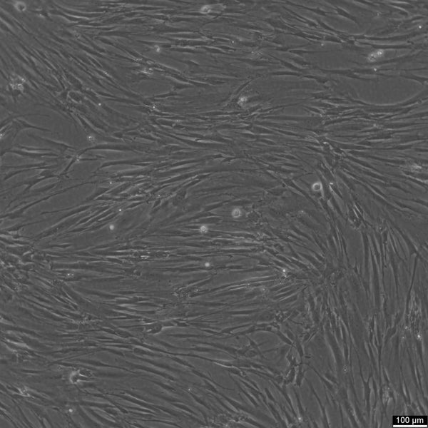 CCD-18Lu cell