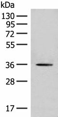 MLST8 Polyclonal Antibody – Figure 1 of 2