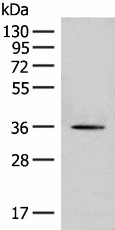 MLST8 Polyclonal Antibody – Figure 1 of 2
