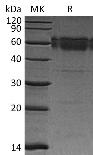Recombinant Mouse TRAIL R2/TNFRSF10B Protein (Fc Tag) – Figure 1 of 2