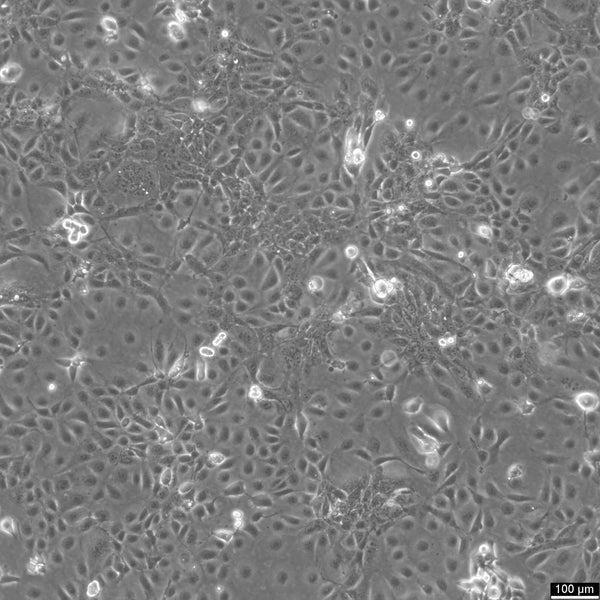 CERV-215 cell
