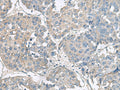 NPHP1 Polyclonal Antibody – Figure 1 of 3