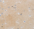 MMP25 Polyclonal Antibody – Figure 1 of 2