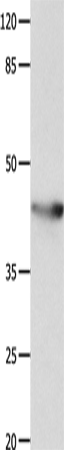 KCNA5 Polyclonal Antibody – Figure 1 of 2