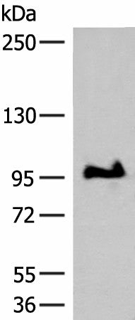 GANC Polyclonal Antibody – Figure 1 of 4