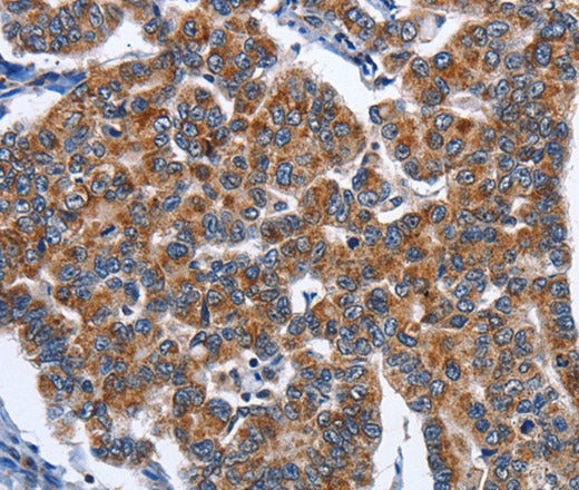CADM3 Polyclonal Antibody – Figure 1 of 3