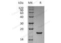 Recombinant Human LIF Protein (E.coli) – Figure 1 of 2