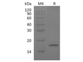 Recombinant Human Interleukin-18/IL-18 Protein – Figure 1 of 2