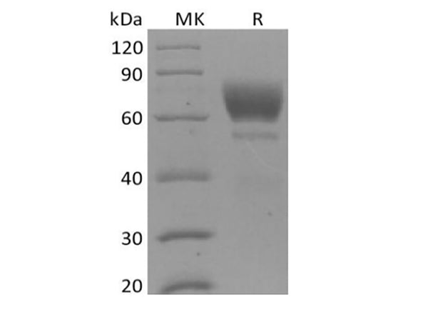 Recombinant Mouse Tyrosine-protein kinase receptor UFO/AXL oncogene/UFO (C-6His) – Figure 1 of 2