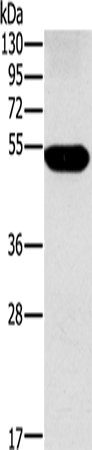 FUCA1 Polyclonal Antibody – Figure 1 of 4