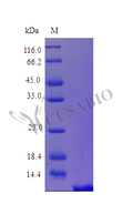 Recombinant Human Parathyroid hormone protein (PTH), partial (Active) – Figure 1 of 1