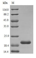 Recombinant Rat Prolactin protein (Prl) (Active) – Figure 1 of 1