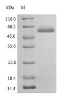 Recombinant Human Protein disulfide-isomerase protein (P4HB), partial (Active) – Figure 1 of 1