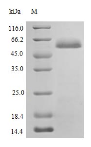 Recombinant Human Protein disulfide-isomerase protein (P4HB), partial (Active) – Figure 1 of 1
