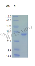 Recombinant Human Fructose-2,6-bisphosphatase TIGAR protein (TIGAR) (Active) – Figure 1 of 1