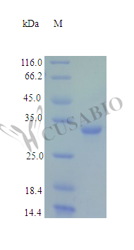 Recombinant Human Fructose-2,6-bisphosphatase TIGAR protein (TIGAR) (Active) – Figure 1 of 1